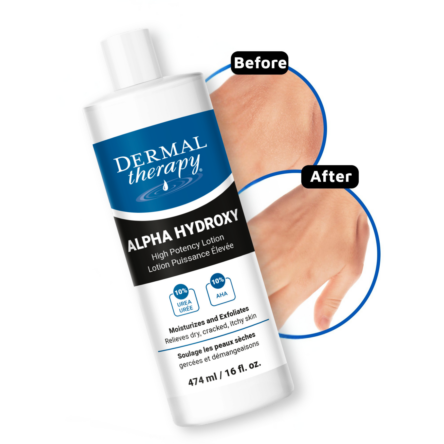 Alpha Hydroxy Lotion
