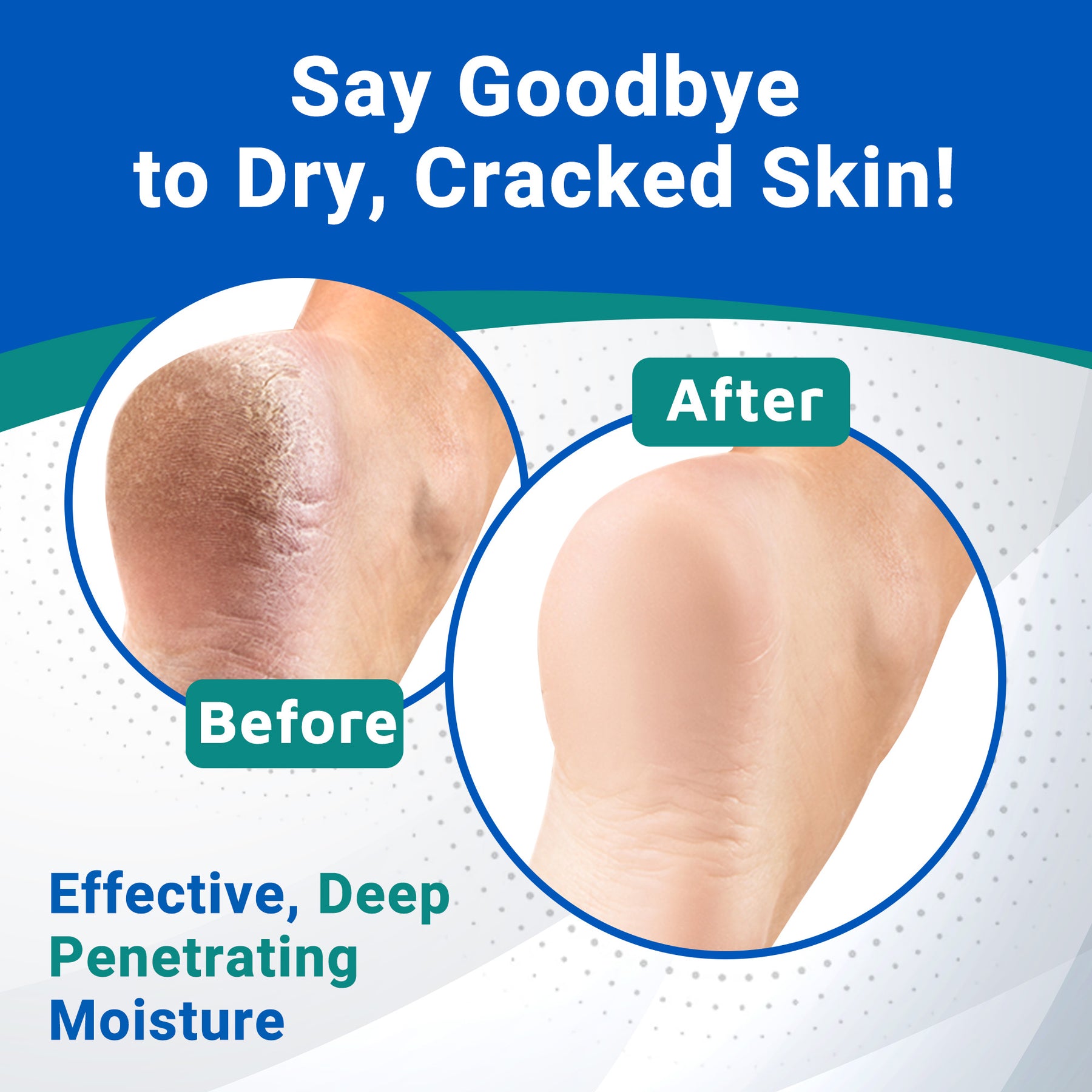 Heel Care Liquid Roll-On