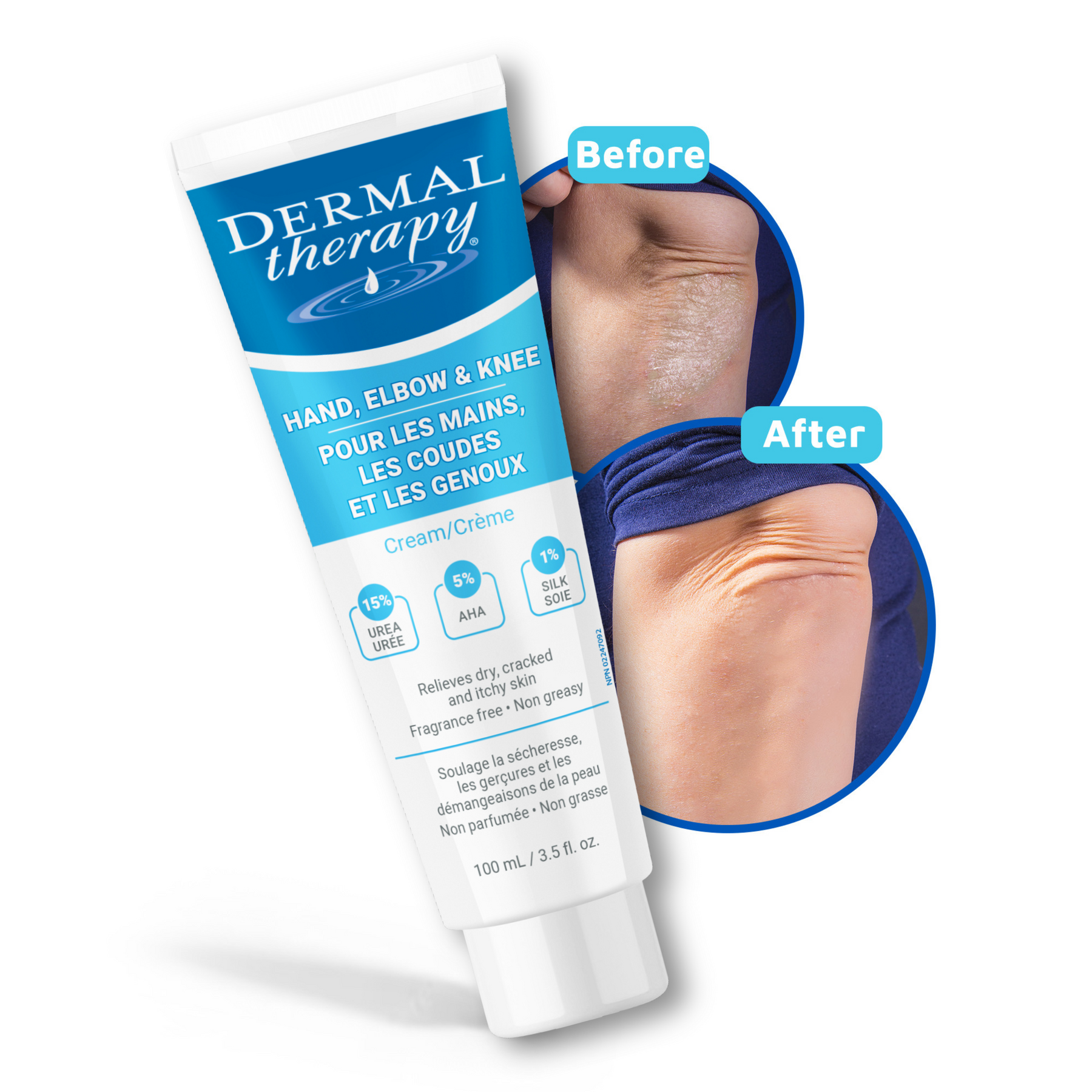 Hand, Elbow & Knee Cream