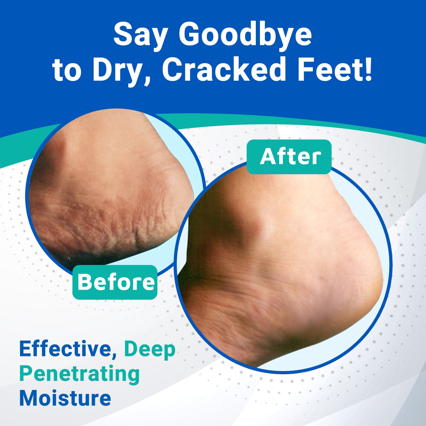 Heel Care Cream