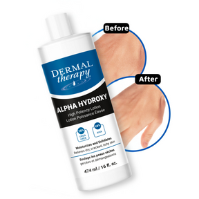 Alpha Hydroxy Lotion
