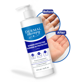 Barrier Protection Lotion