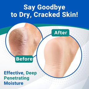 Heel Care Liquid Roll-On