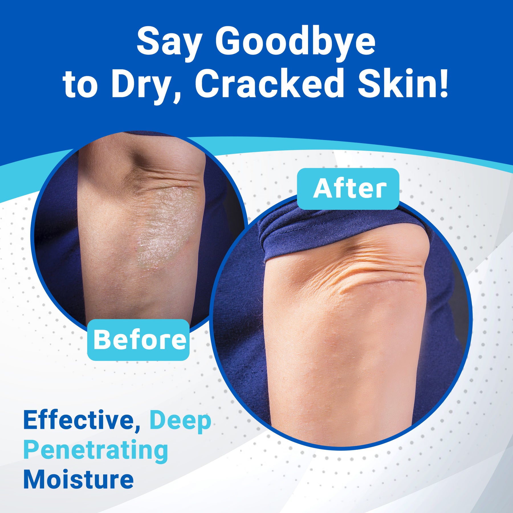 Hand, Elbow & Knee Cream