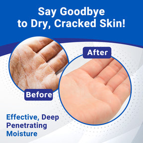 Barrier Protection Lotion