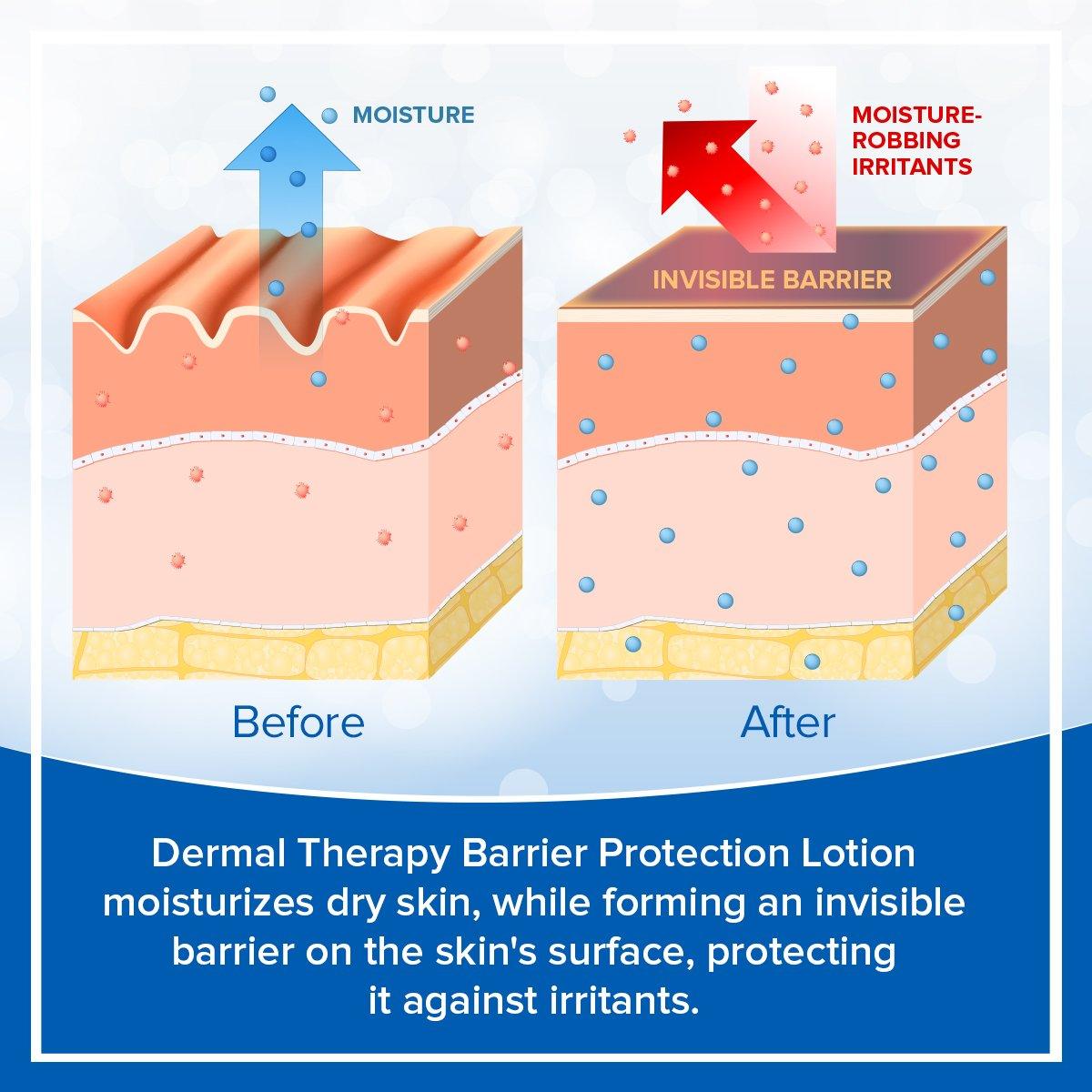 Barrier Protection Lotion - Dermal Therapy™ 1% Alpha Hydroxy Acids, 10% Urea, AHA, barrier, Barrier Protection Lotion, dermaltherapy, fragrance-free, irritants, Lotion, Moisturizer, non-greasy, petrolatum-free, protection, silk proteins, urea, very dry skin Lotion 1% Alpha Hydroxy Acids, 10% Urea, AHA, barrier, Barrier Protection Lotion, dermaltherapy, fragrance-free, irritants, Lotion, Moisturizer, non-greasy, petrolatum-free, protection, silk proteins, urea, very dry skin